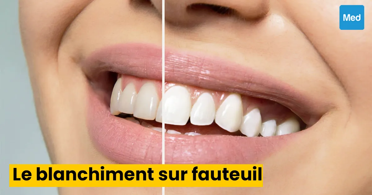 Le blanchiment sur fauteuil : tout ce que vous devez savoir